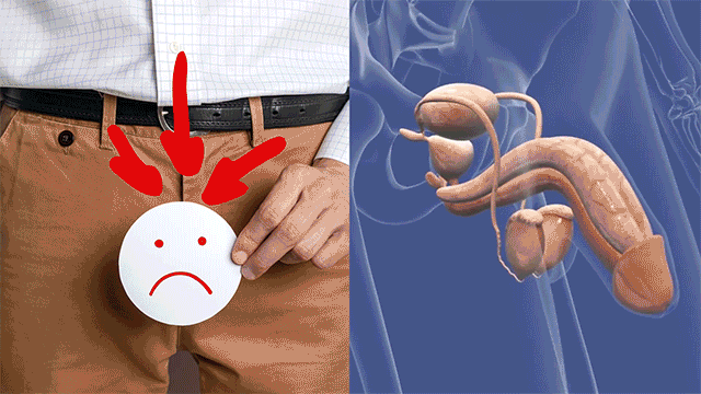 Animated illustration of male erectile-function concern beside anatomical context
